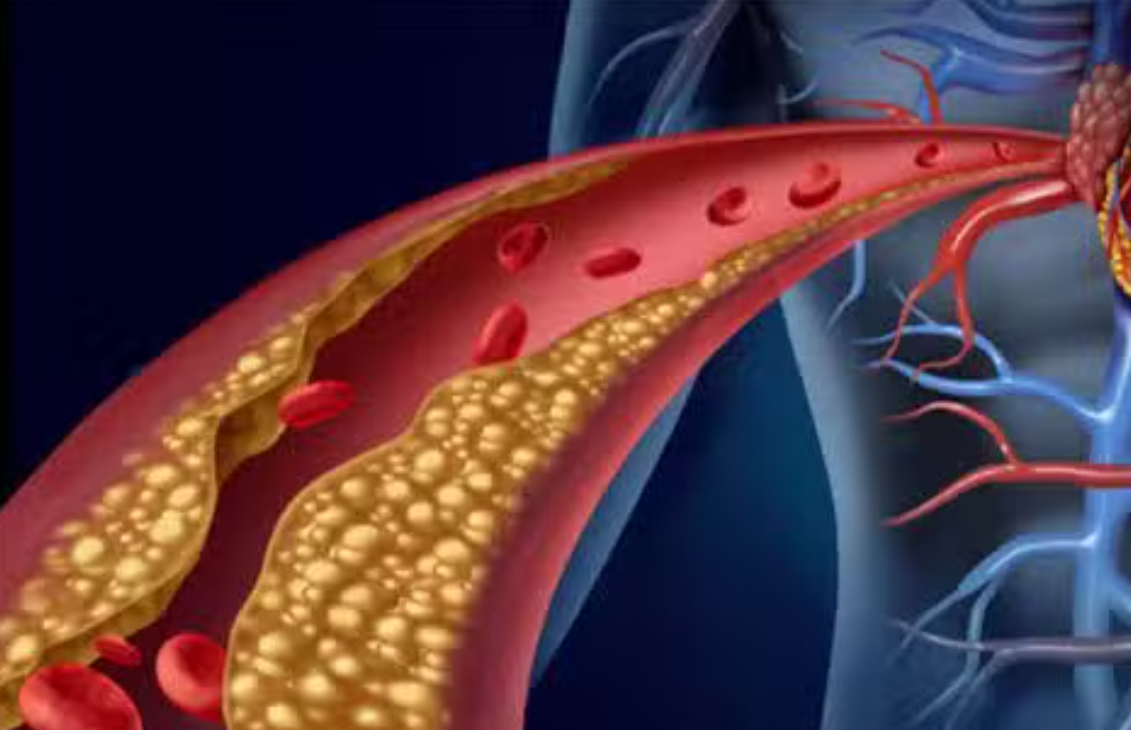 animación cuerpo humano y colesterol