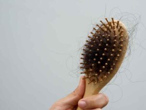 cepillo lleno de cabello que se cayó debido a las hormonas